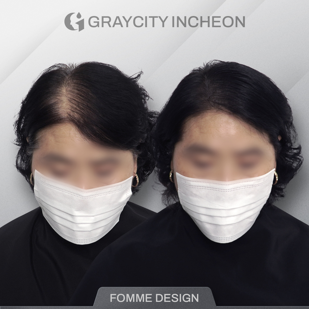 그레이시티 인천직영점 대표 이미지