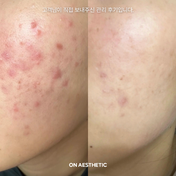 온에스테틱 선릉점 대표 이미지