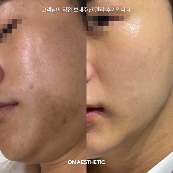 온에스테틱 선릉점 대표 이미지