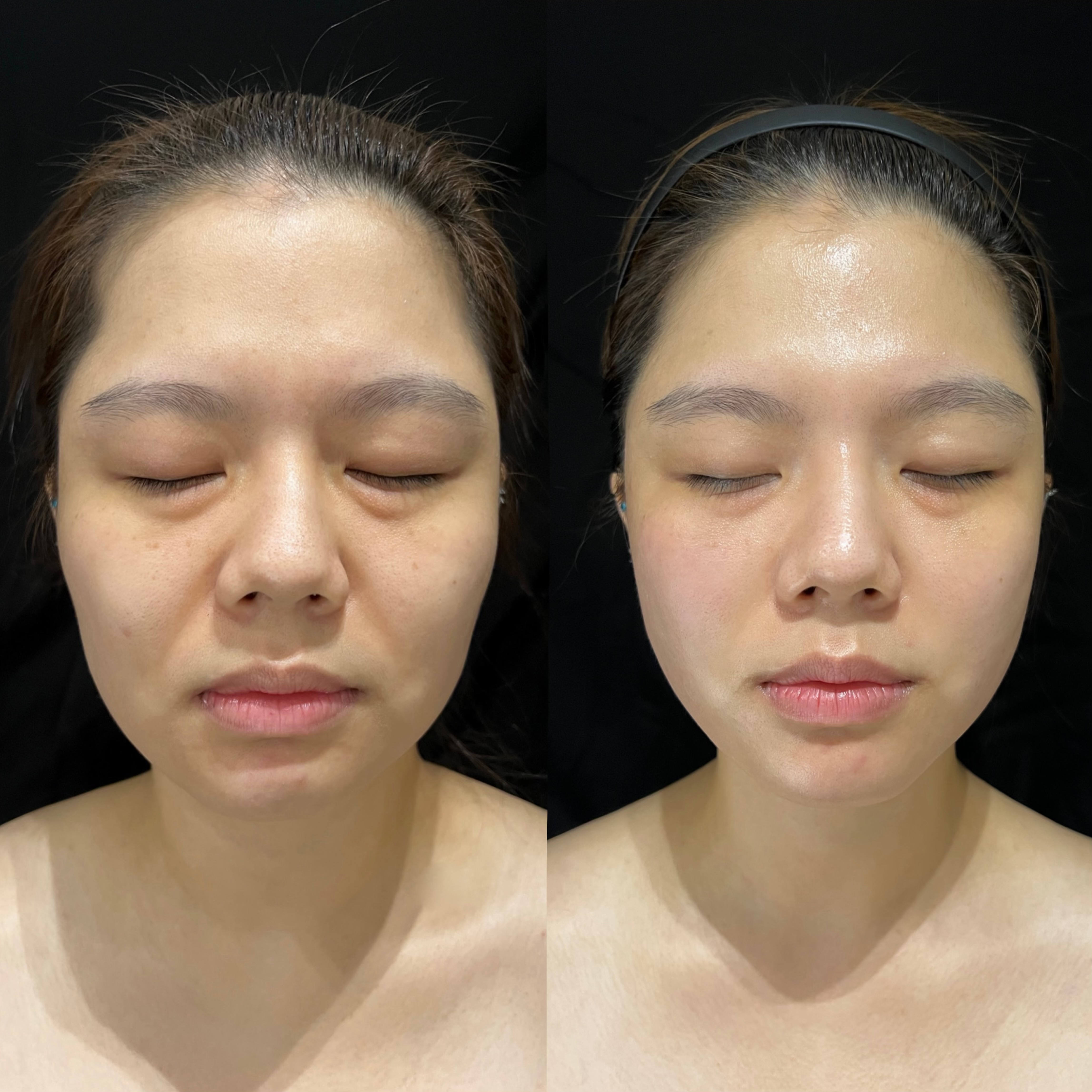 온에스테틱 압구정점 대표 이미지