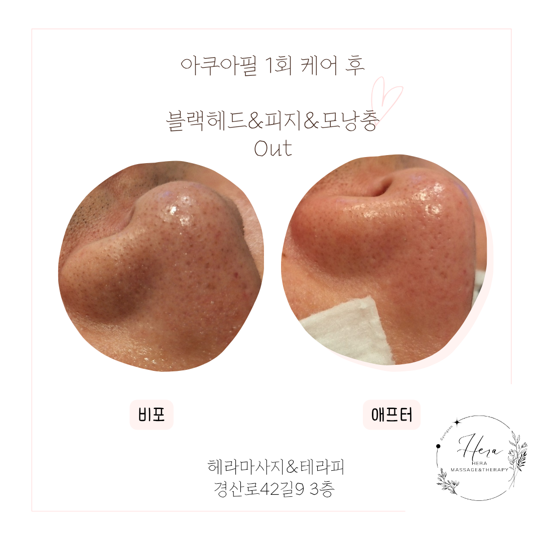 헤라마사지&테라피 photo 4