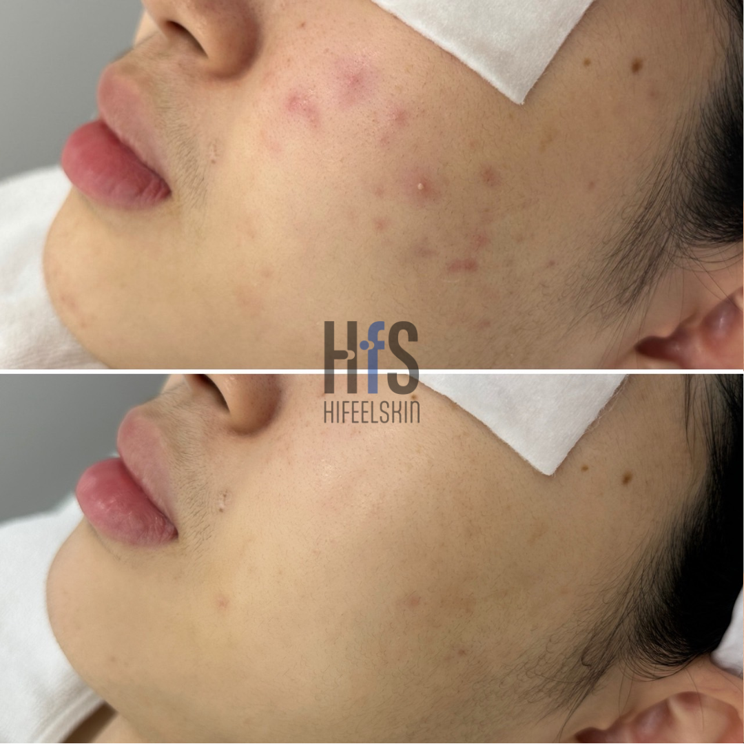 하이필스킨 여의도점 대표 이미지