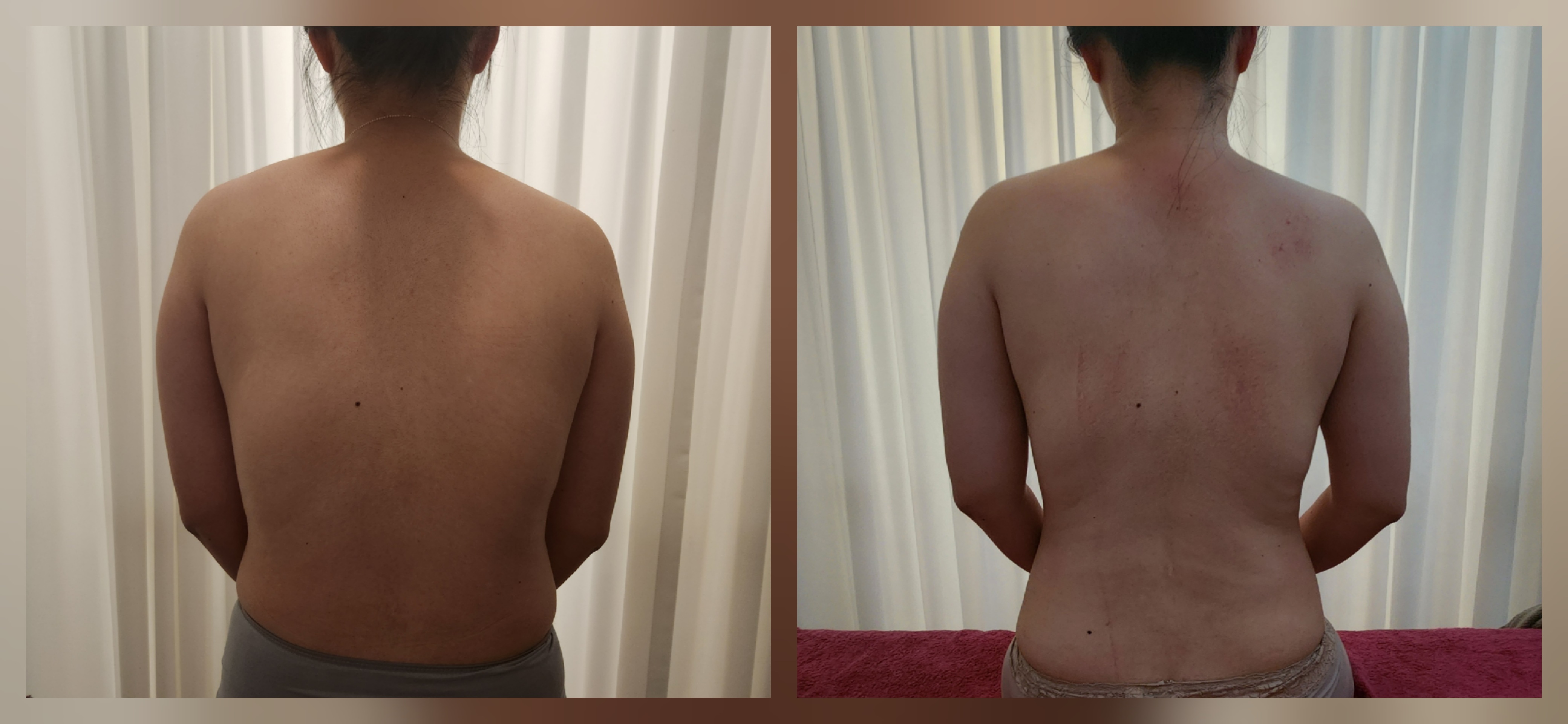 라파엘테라피 photo 10