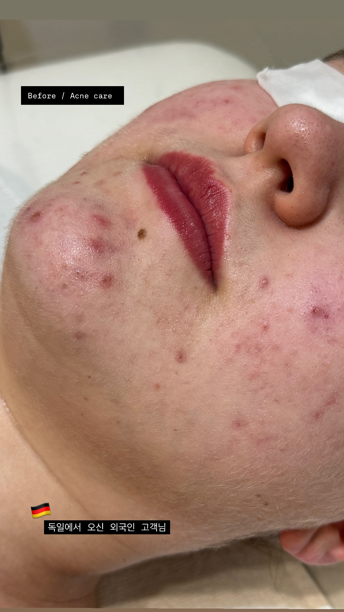 다이브인투스킨 대표 이미지