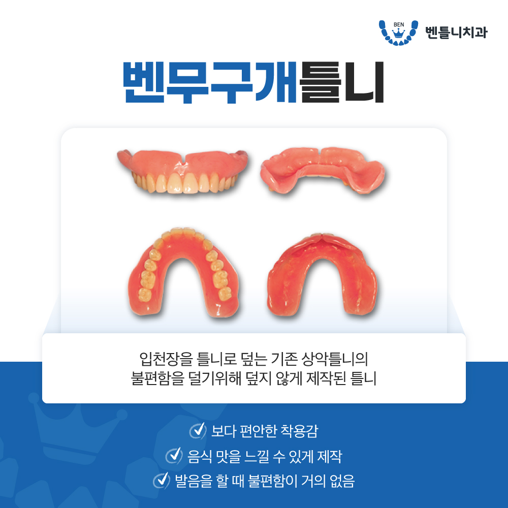 벤틀니치과 대표 이미지