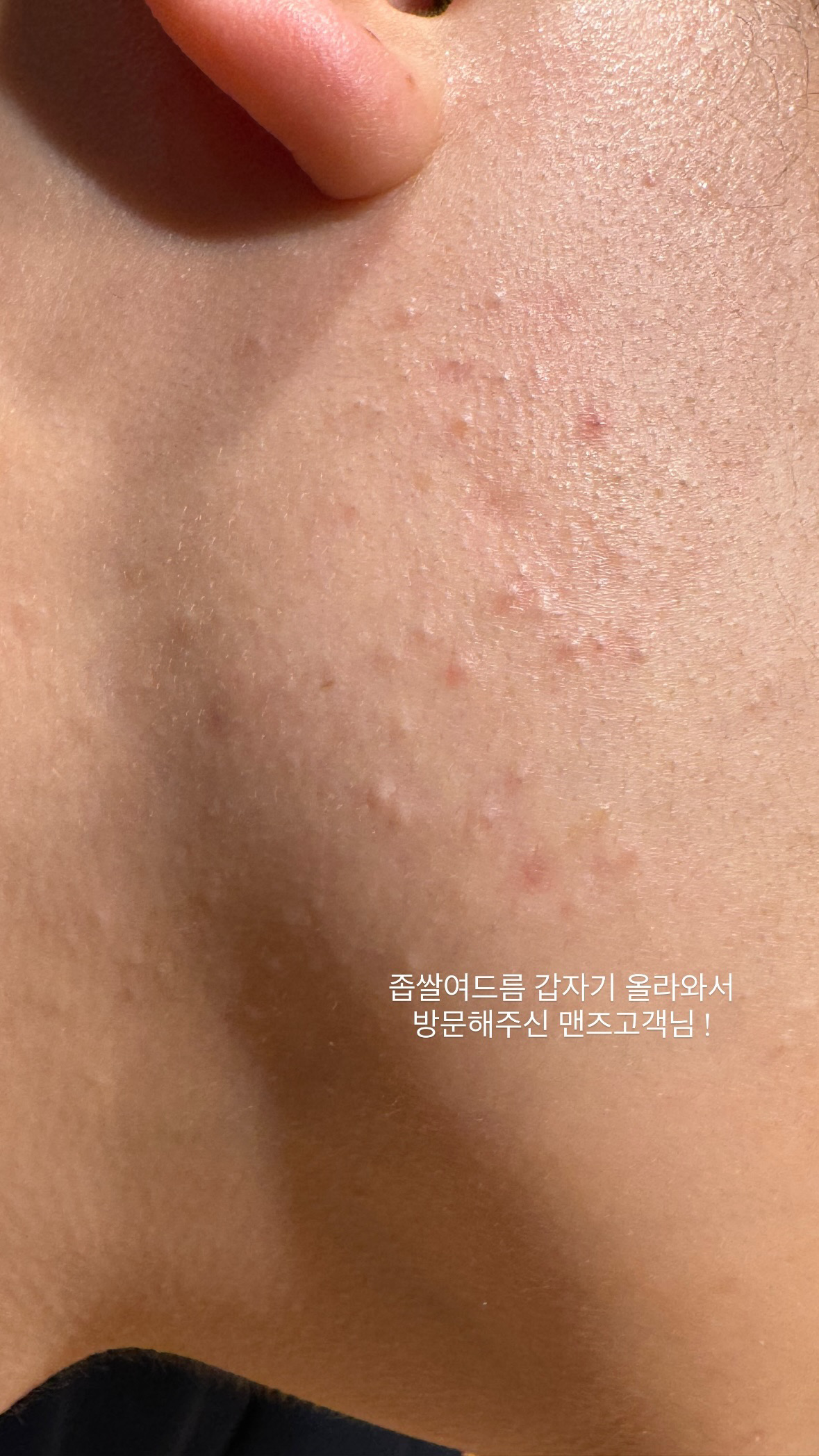 다이브인투스킨 대표 이미지