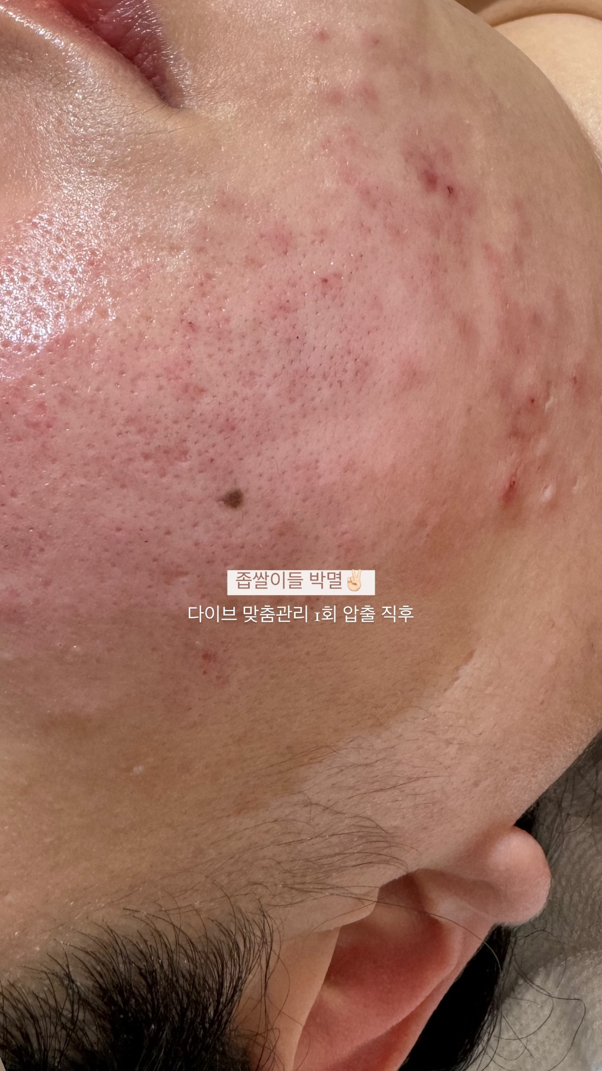 다이브인투스킨 대표 이미지