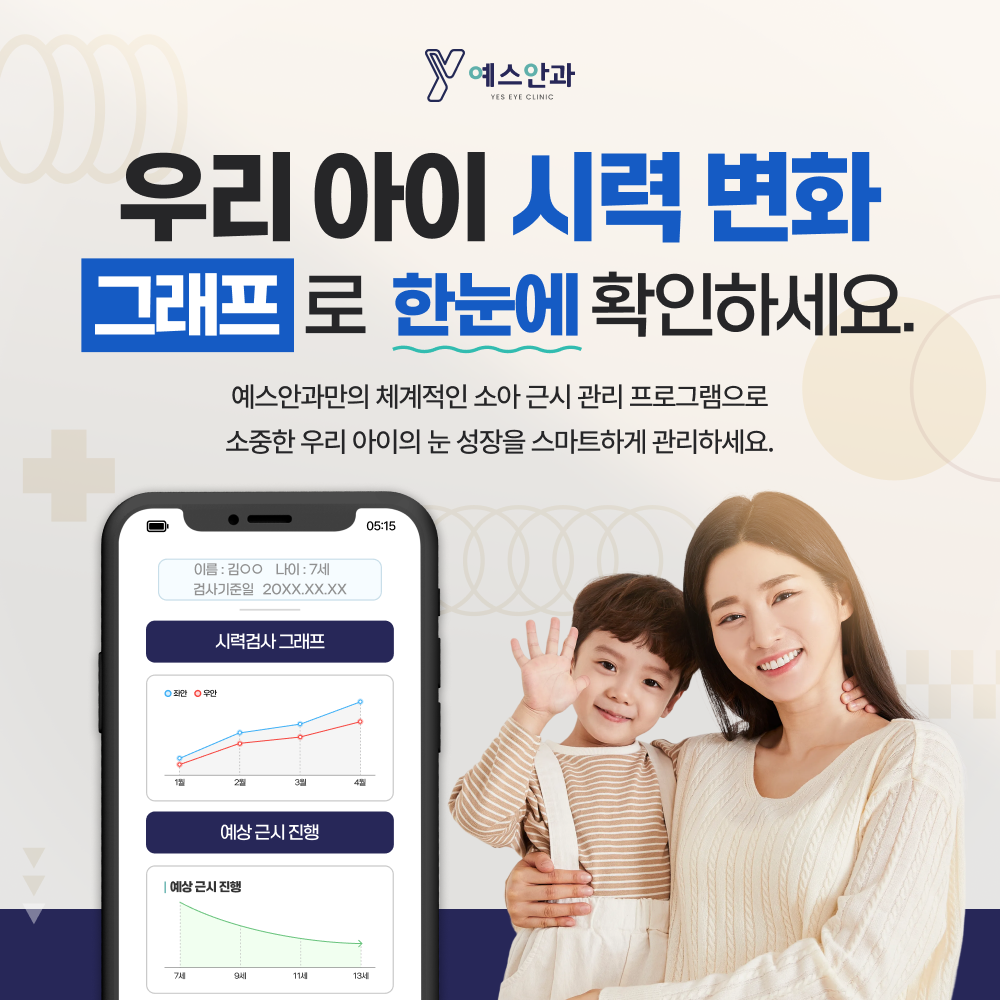 예스안과의원 대표 이미지