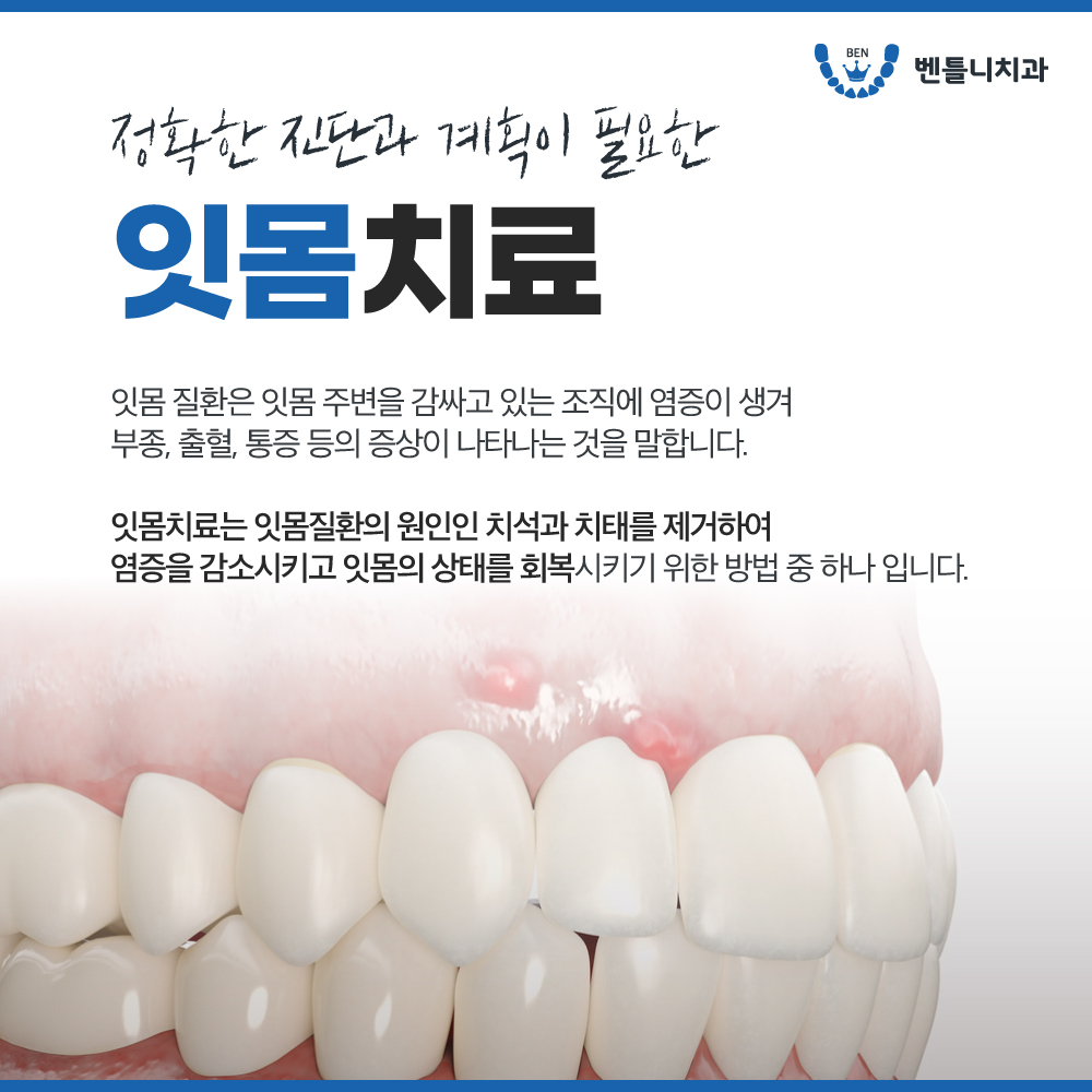 벤틀니치과의원 대표 이미지