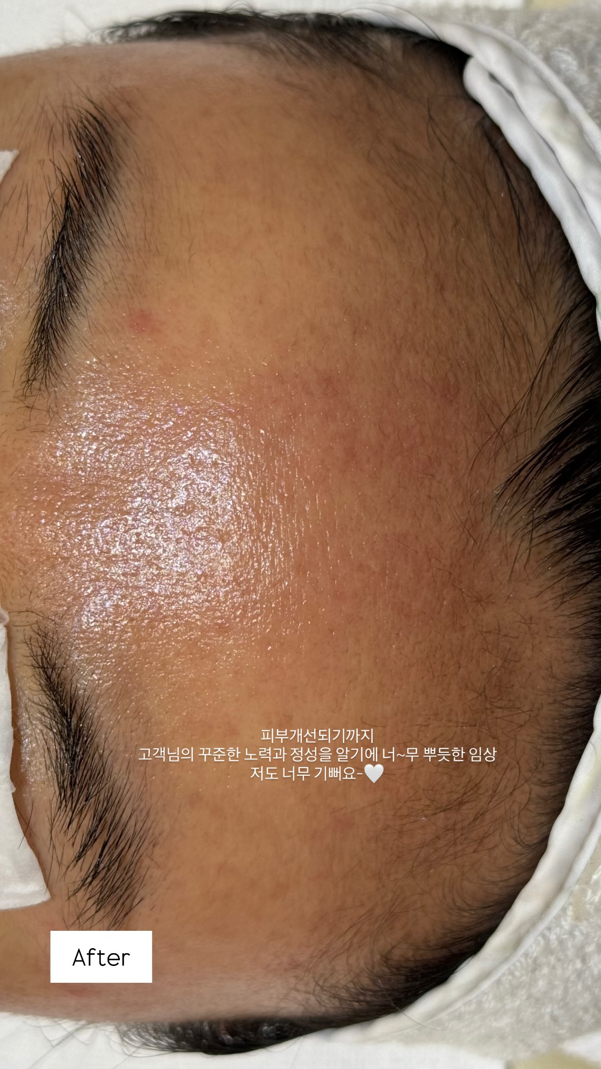 다이브인투스킨 대표 이미지