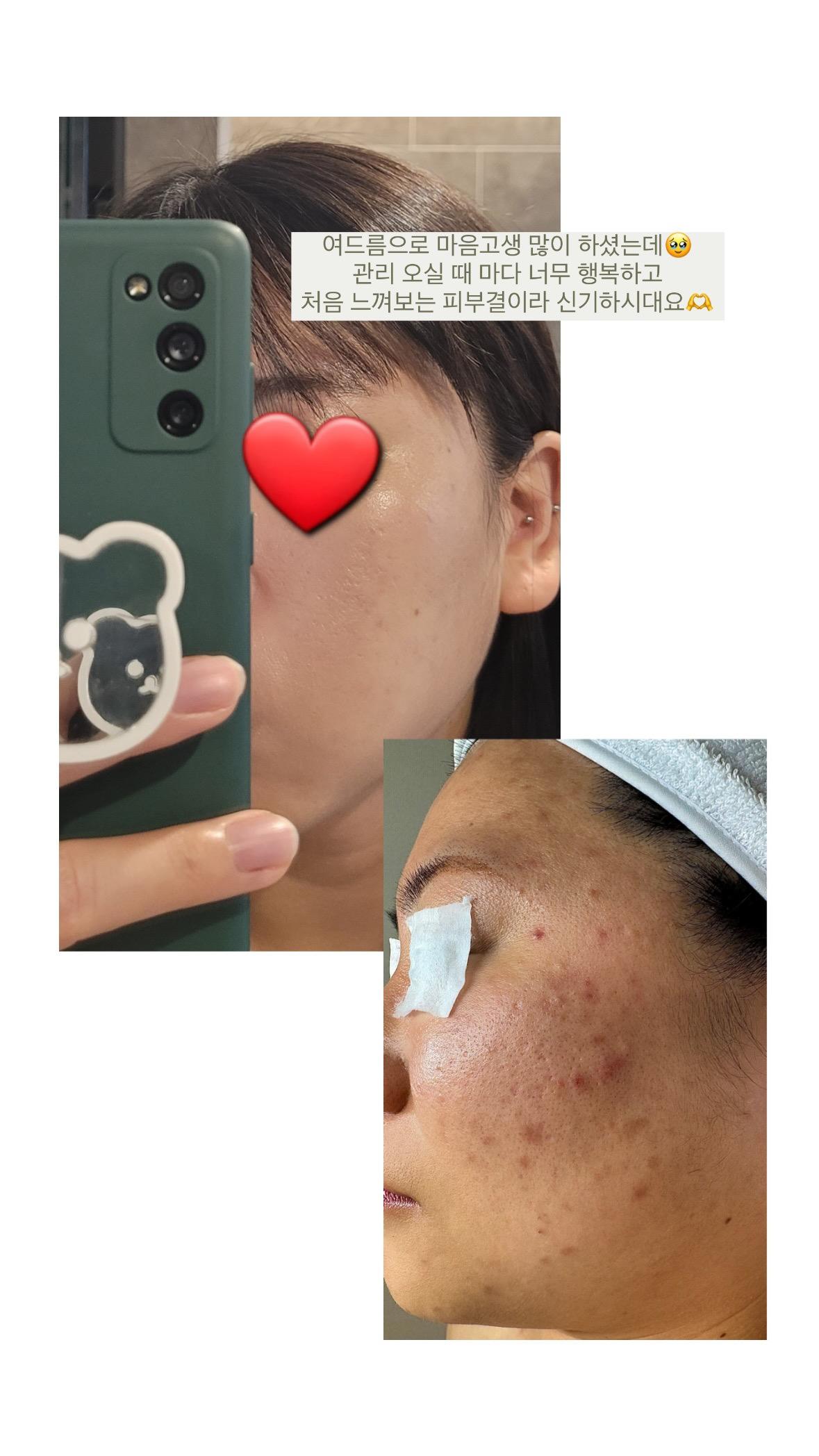 다이브인투스킨 대표 이미지