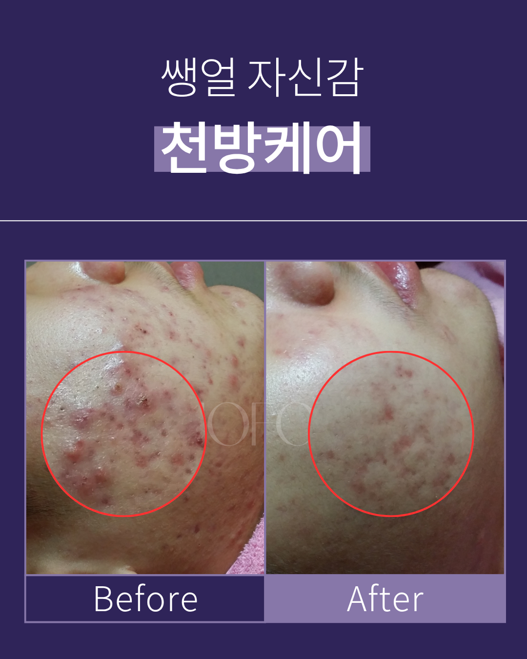 수만금에스테 대표 이미지
