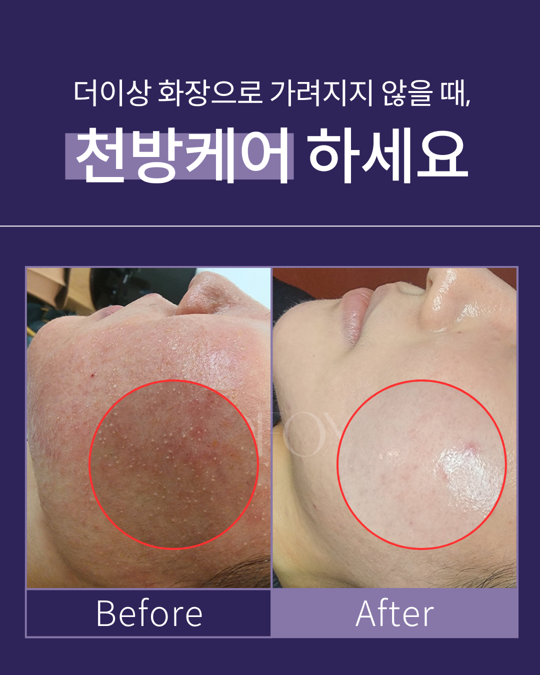 수만금에스테 대표 이미지