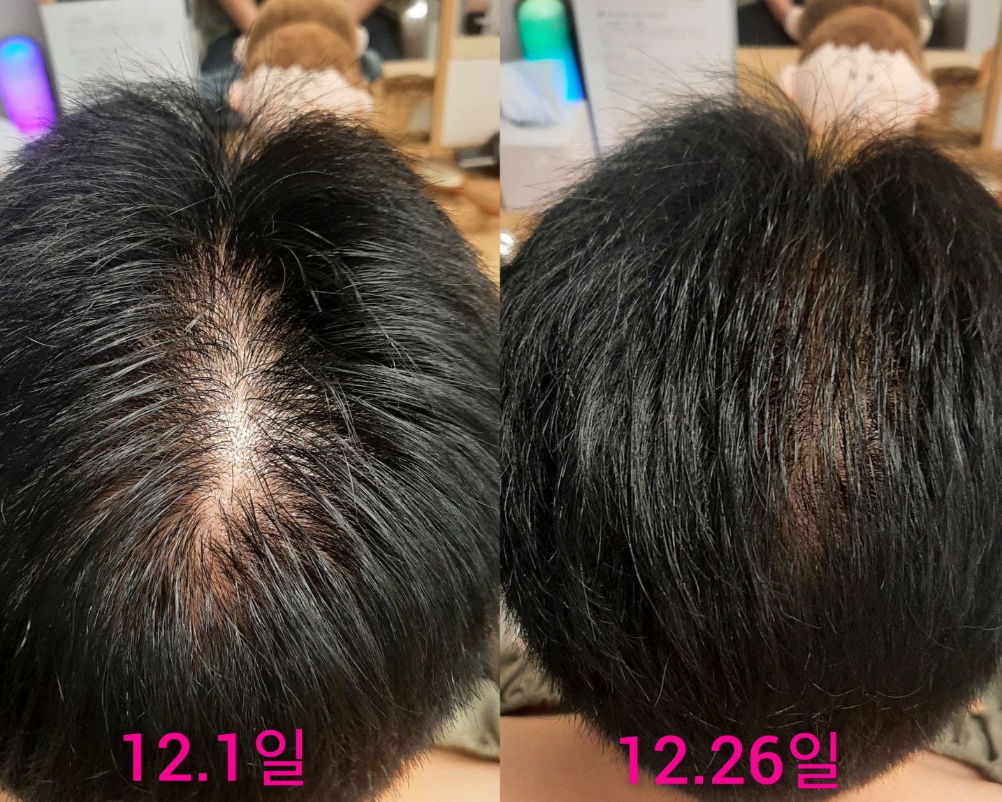 숲칼프 대표 이미지