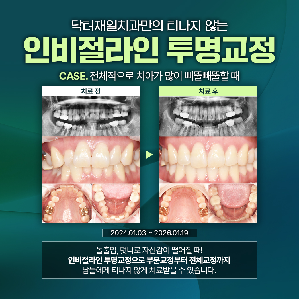 닥터재일치과 대표 이미지