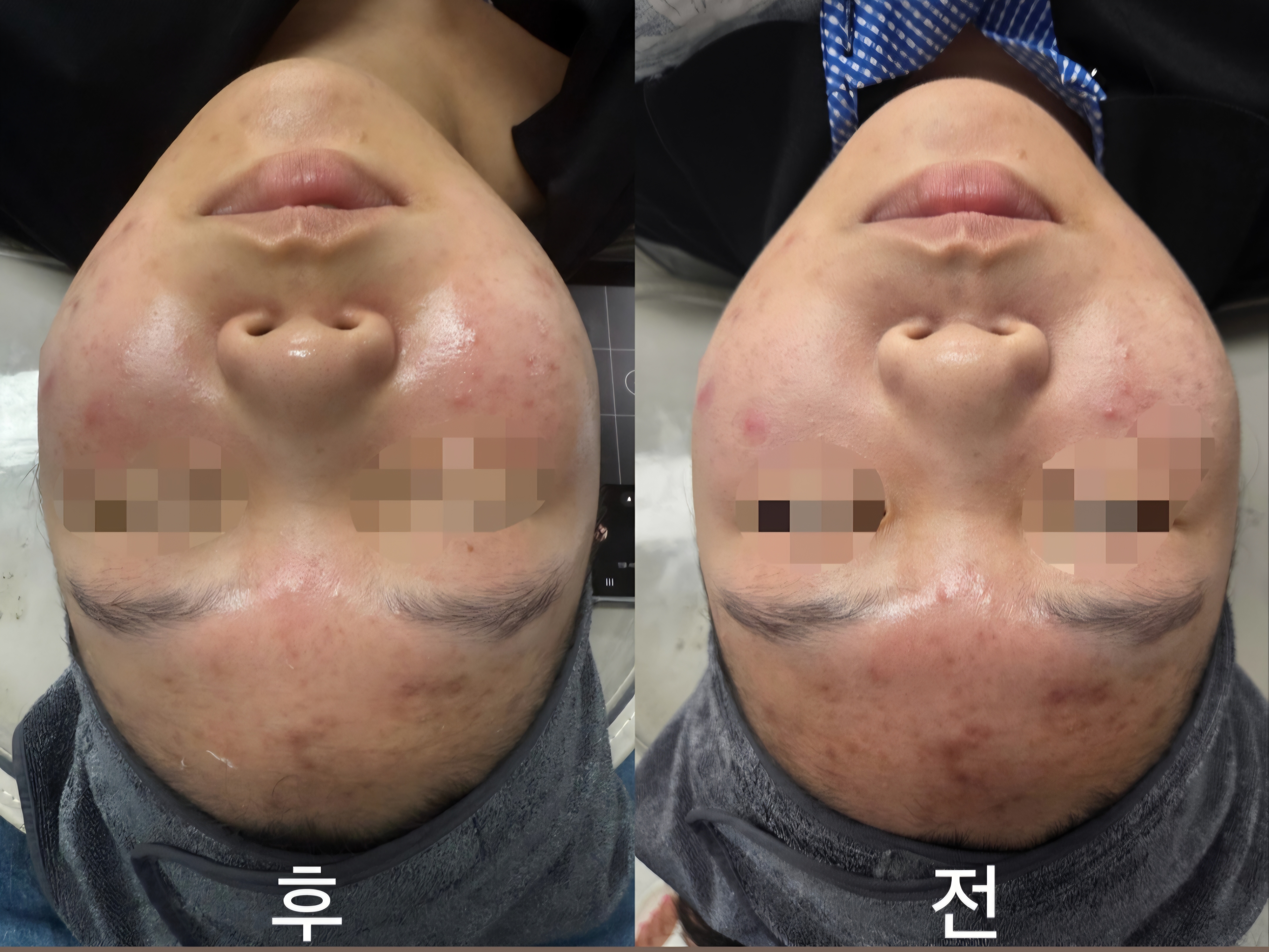 래쉬&라인 대표 이미지