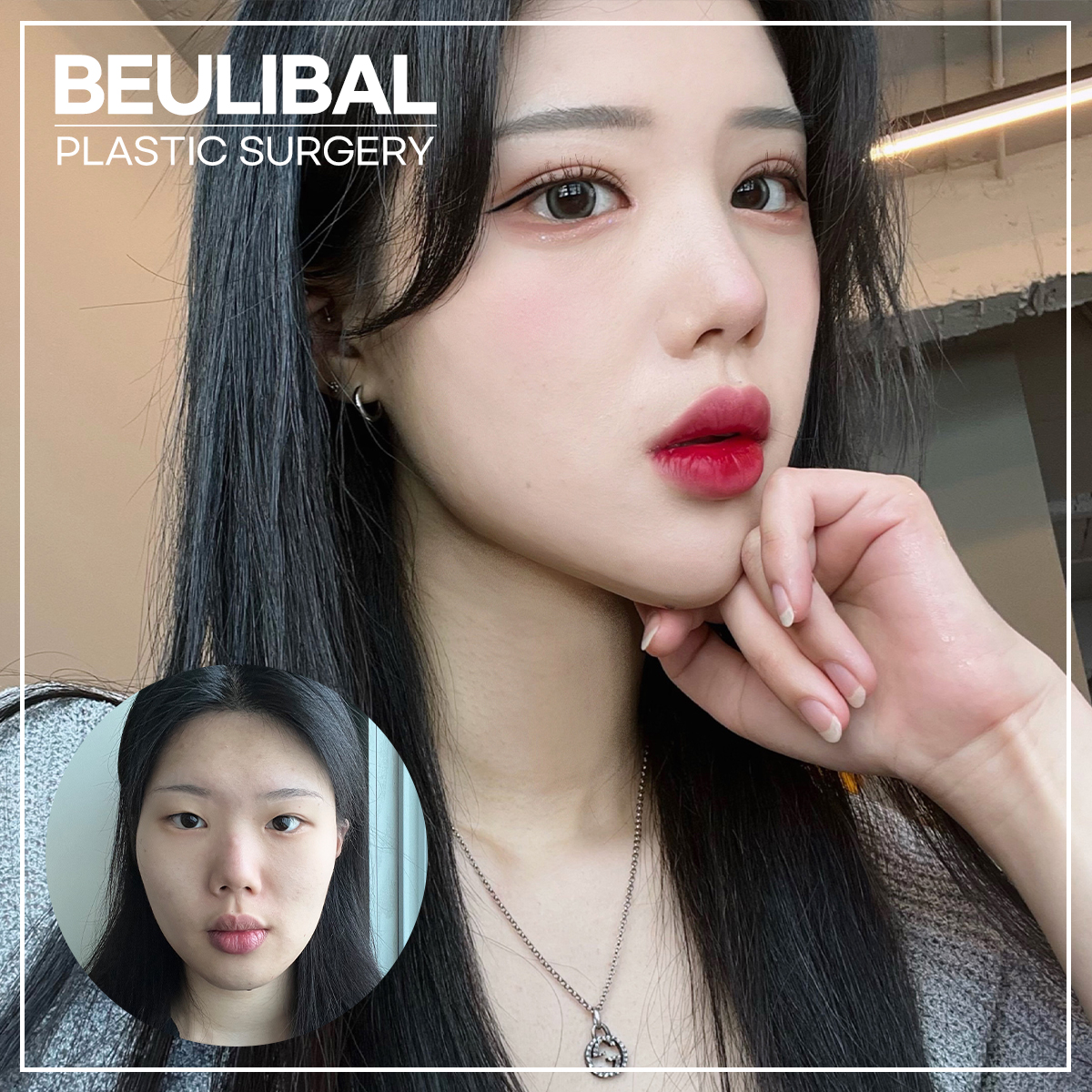 뷰라밸성형외과의원 프런트