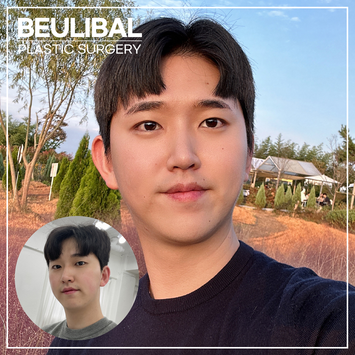 뷰라밸성형외과 대표 이미지