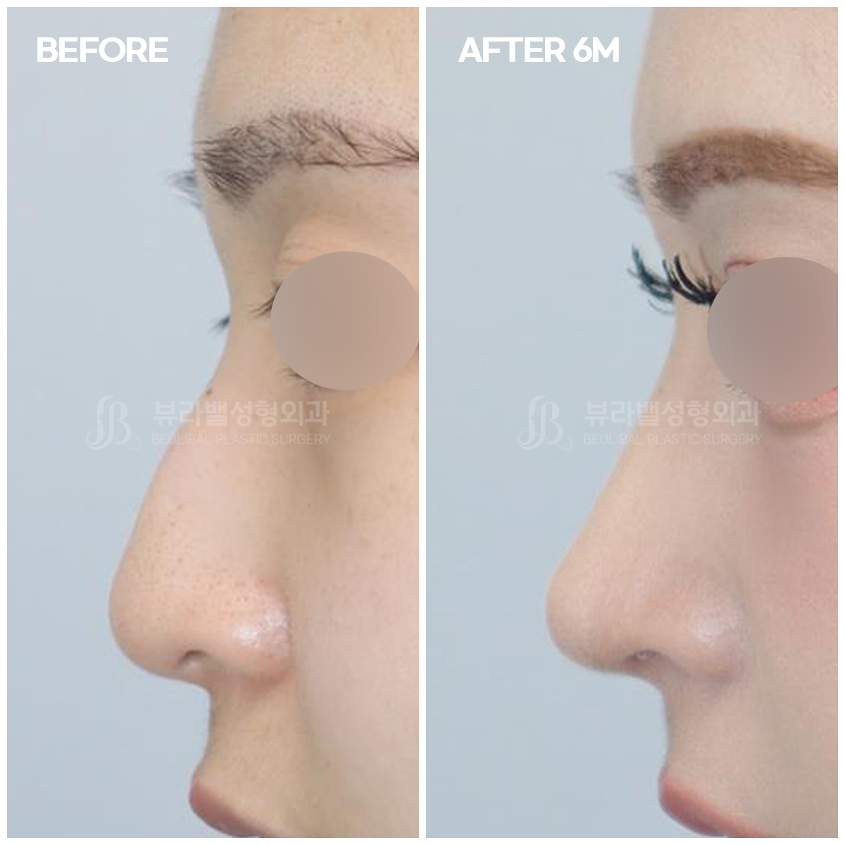 뷰라밸성형외과의원 대표 이미지