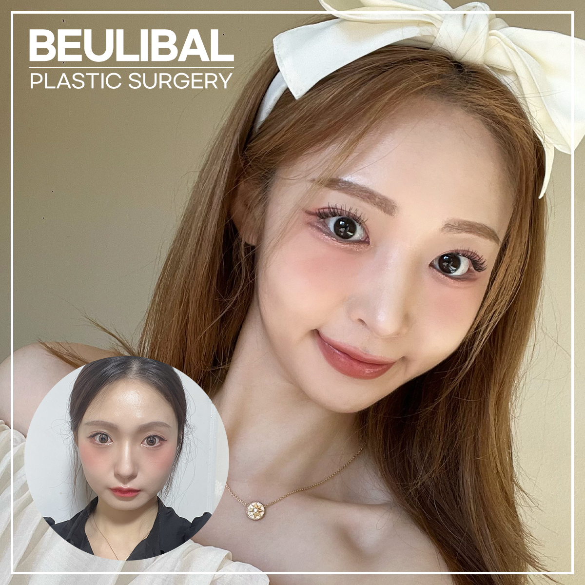 뷰라밸성형외과 대표 이미지