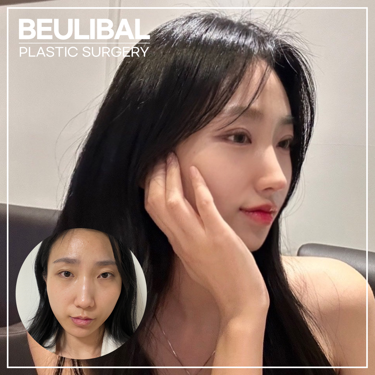 뷰라밸성형외과 대표 이미지