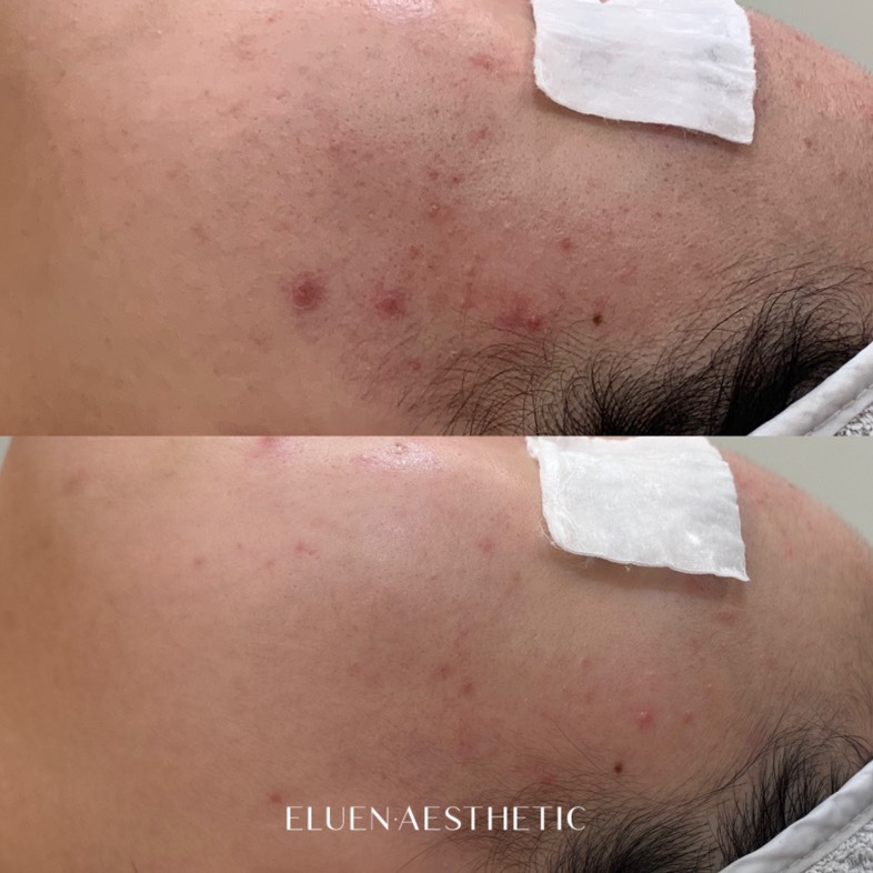 엘루엔에스테틱 대표 이미지