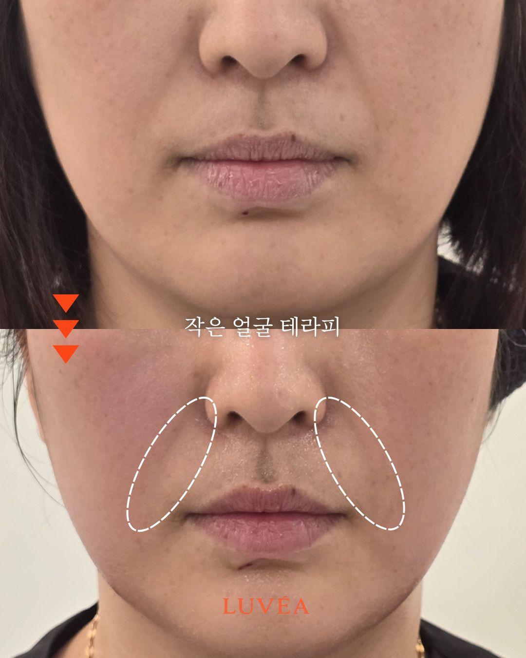 루베아에스테틱 대표 이미지