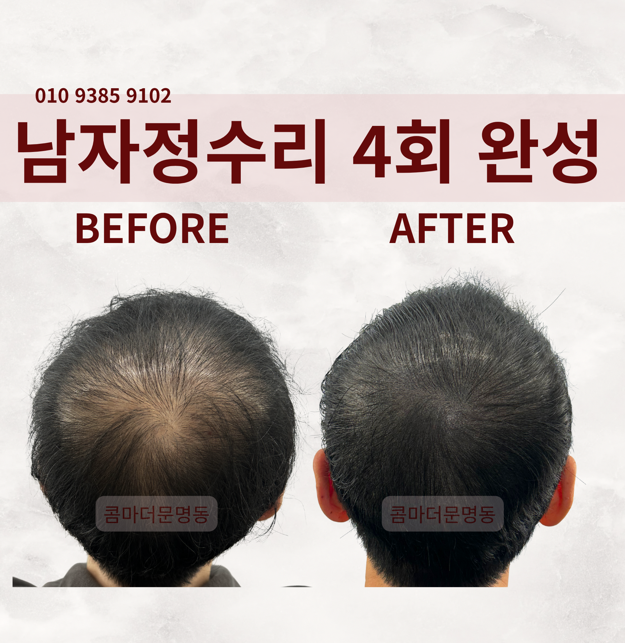 콤마더문 명동 대표 이미지