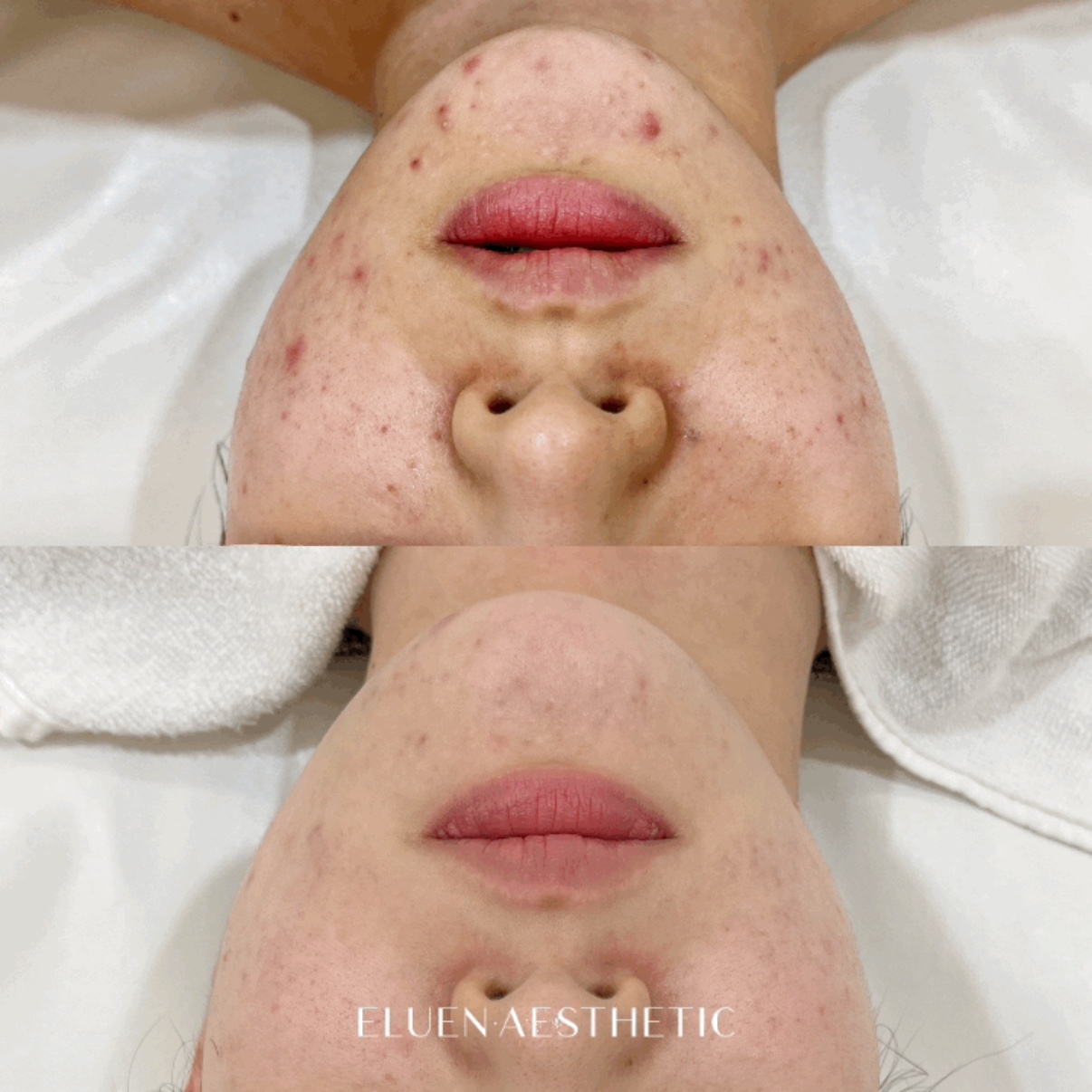 엘루엔에스테틱 홍대점 대표 이미지