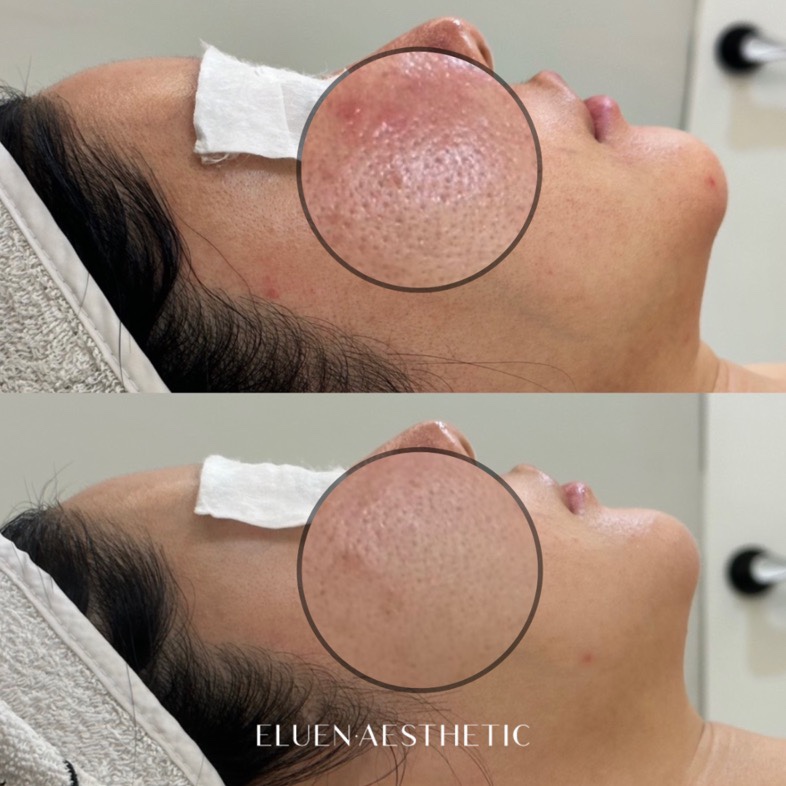 엘루엔에스테틱 홍대점 대표 이미지