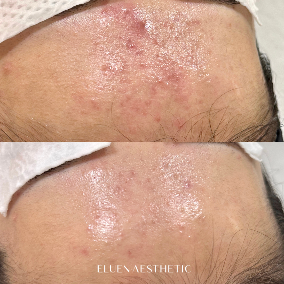 엘루엔에스테틱 대표 이미지