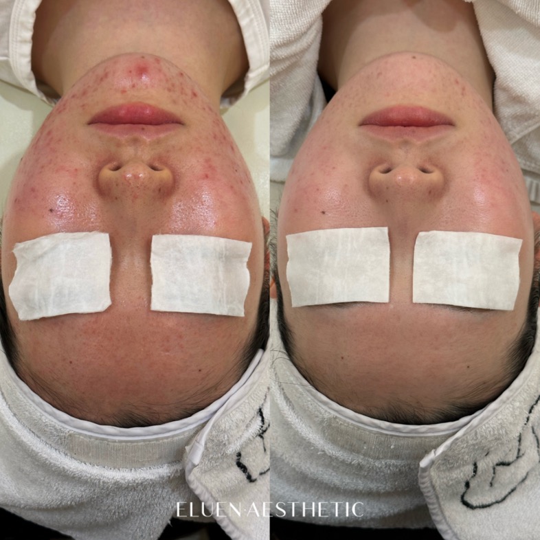 엘루엔에스테틱 대표 이미지