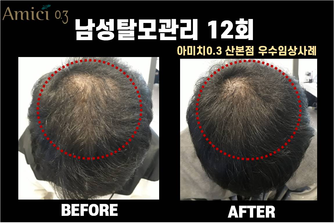 아미치0.3 산본점 대표 이미지