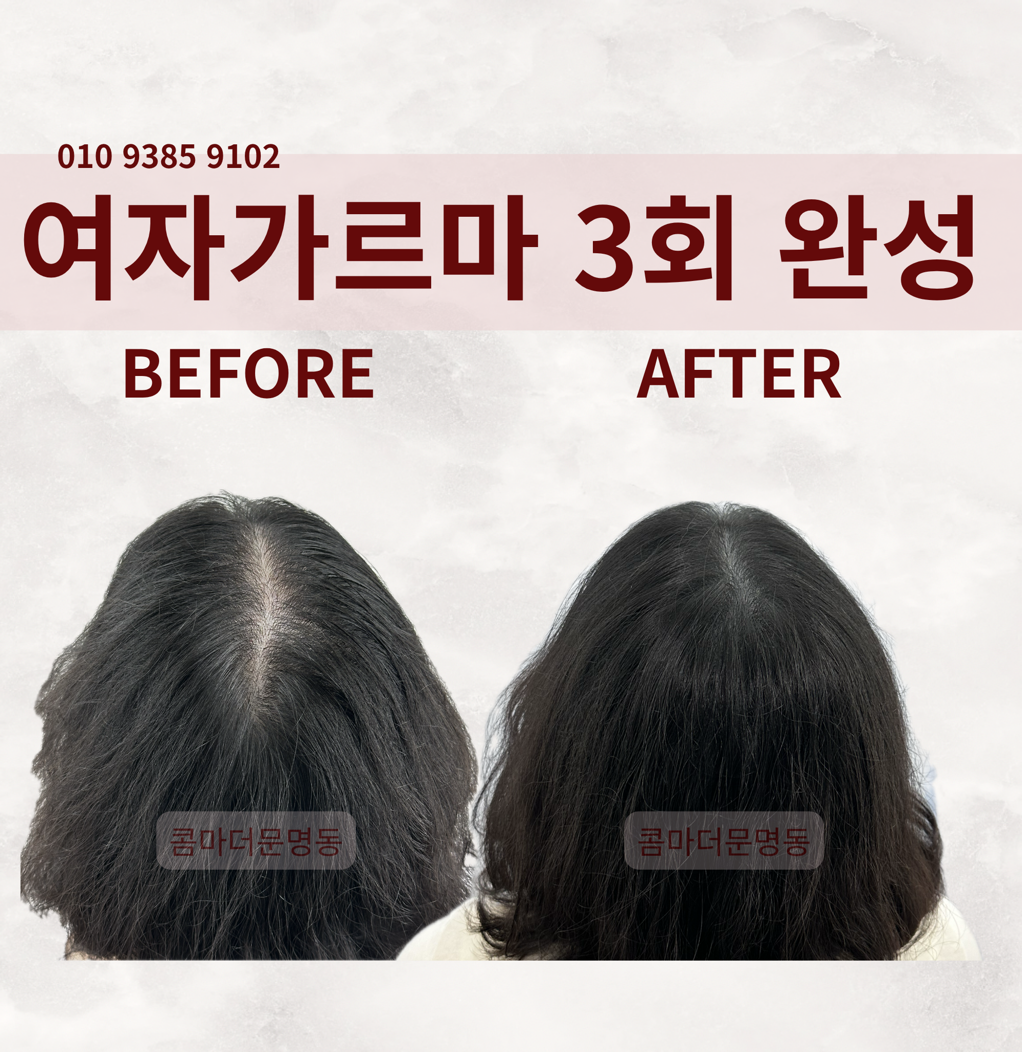 콤마더문 명동 이미지