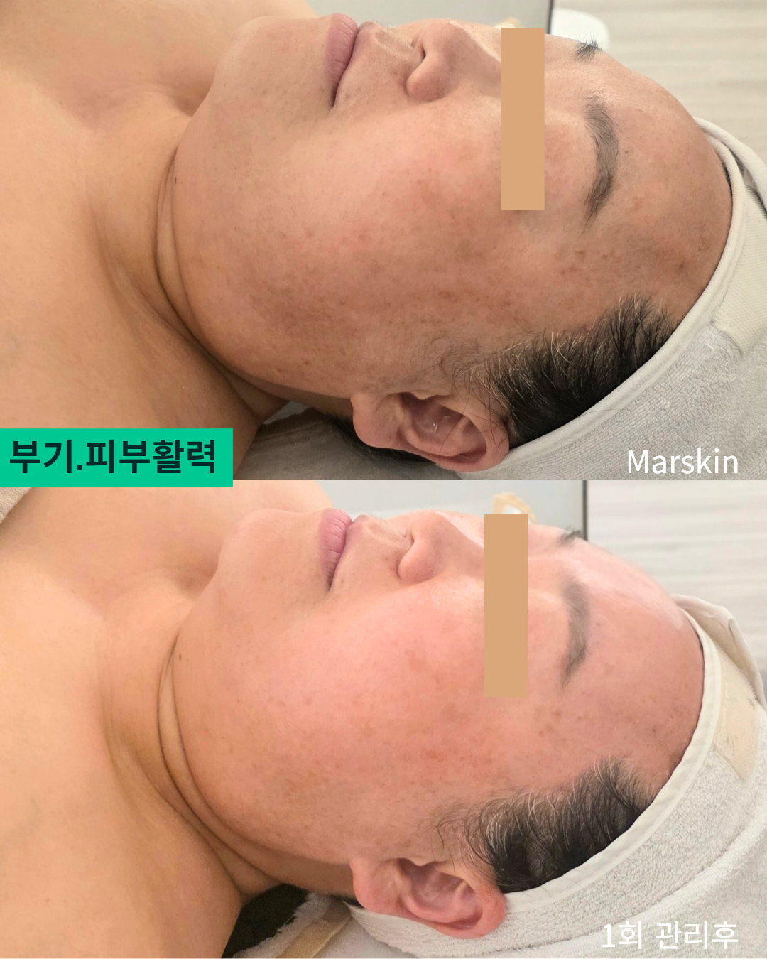 마르스킨 SPA 대표 이미지