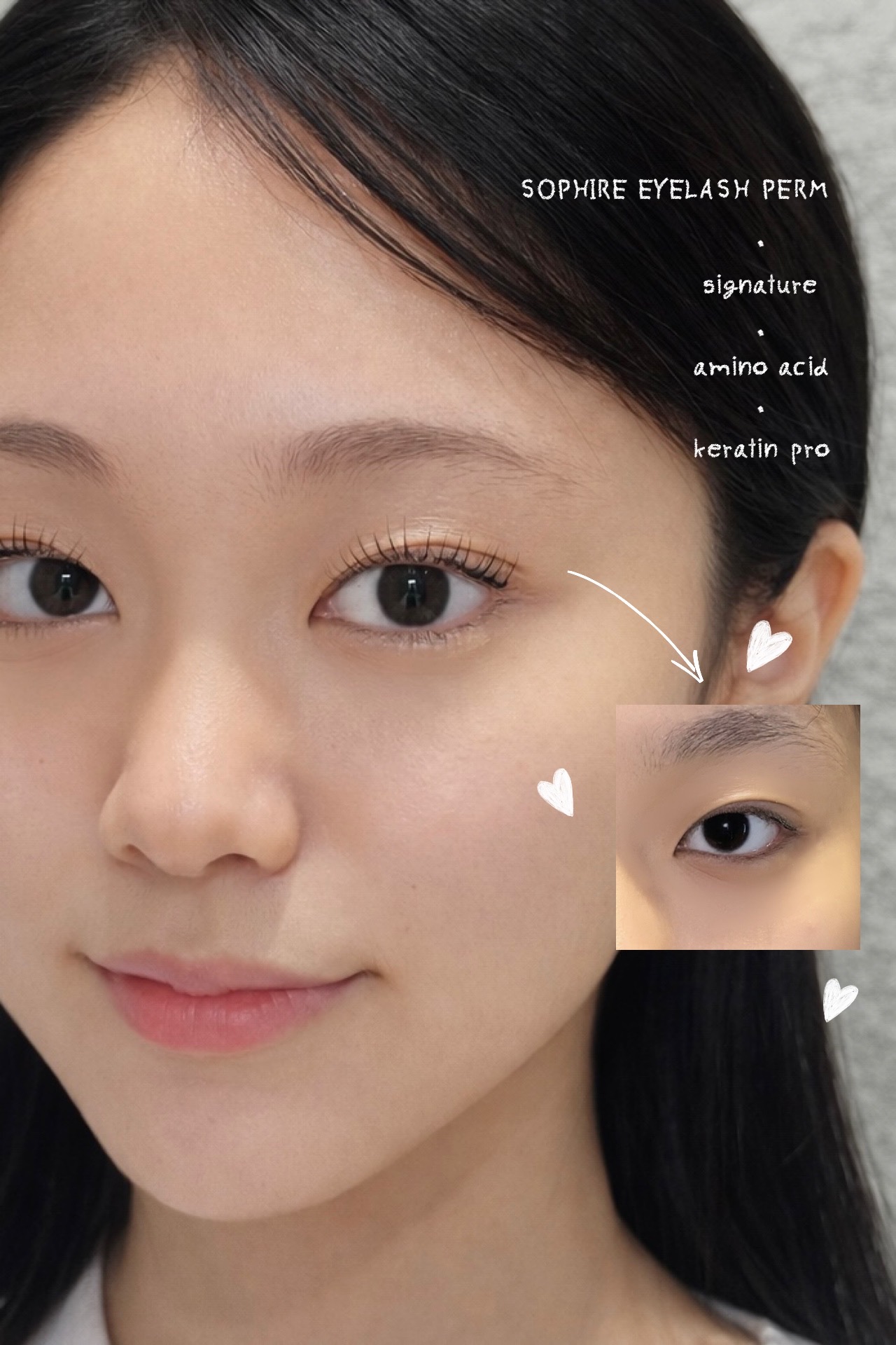 소피레속눈썹 용산 제거