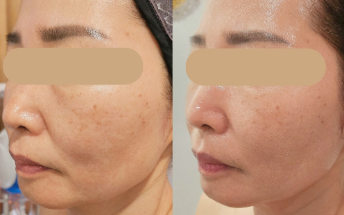 스파포레 노화연구소 photo 10