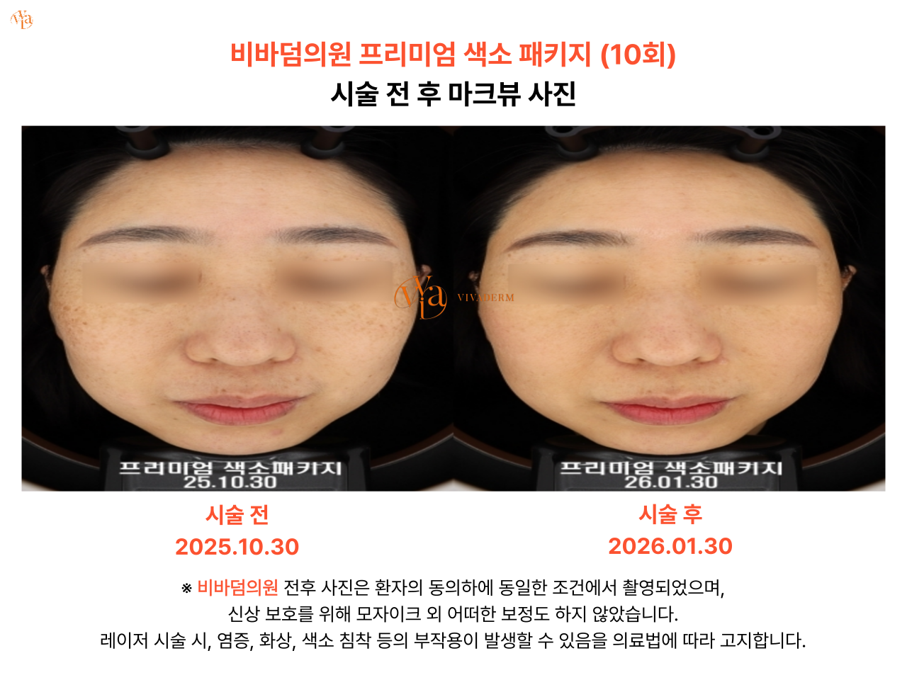 비바덤의원