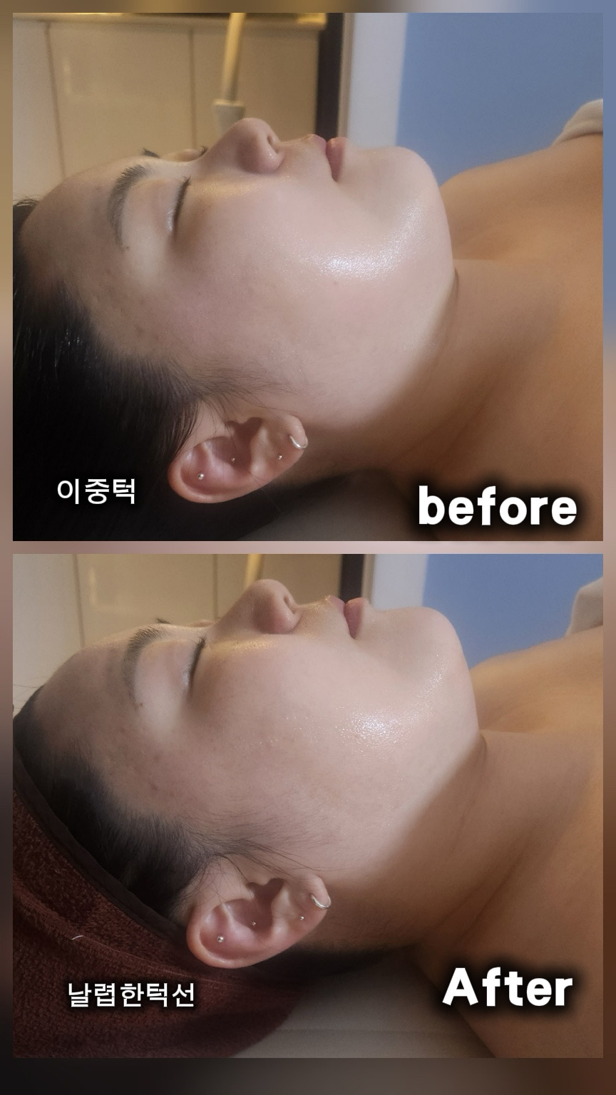 가마지에스테틱 대표 이미지