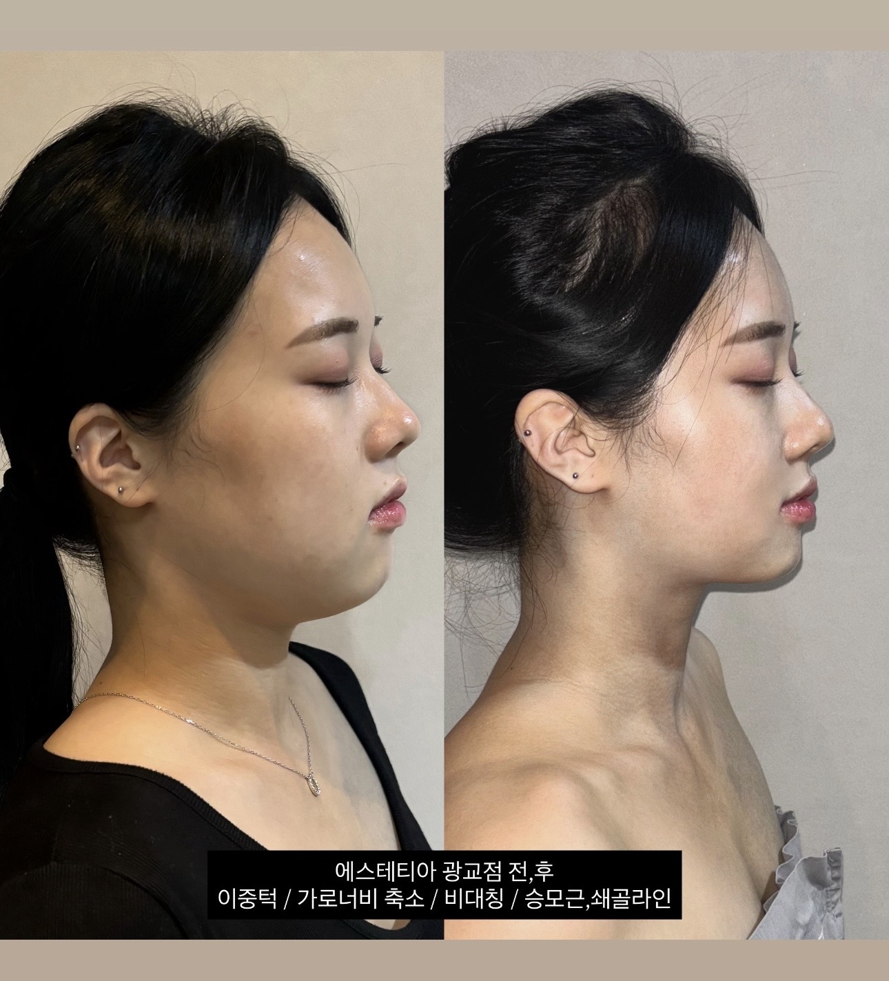 에스테티아 광교1호점 photo 5