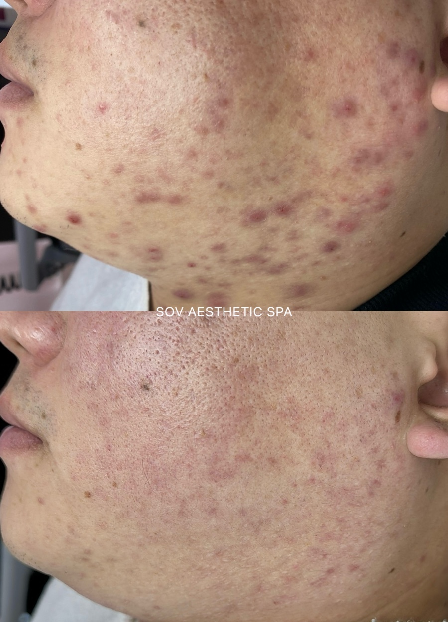 소브에스테틱스파 대표 이미지