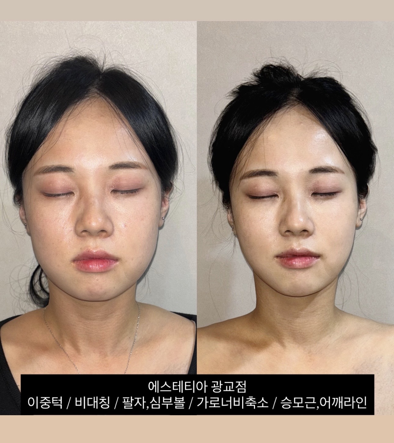 에스테티아 광교1호점 photo 4