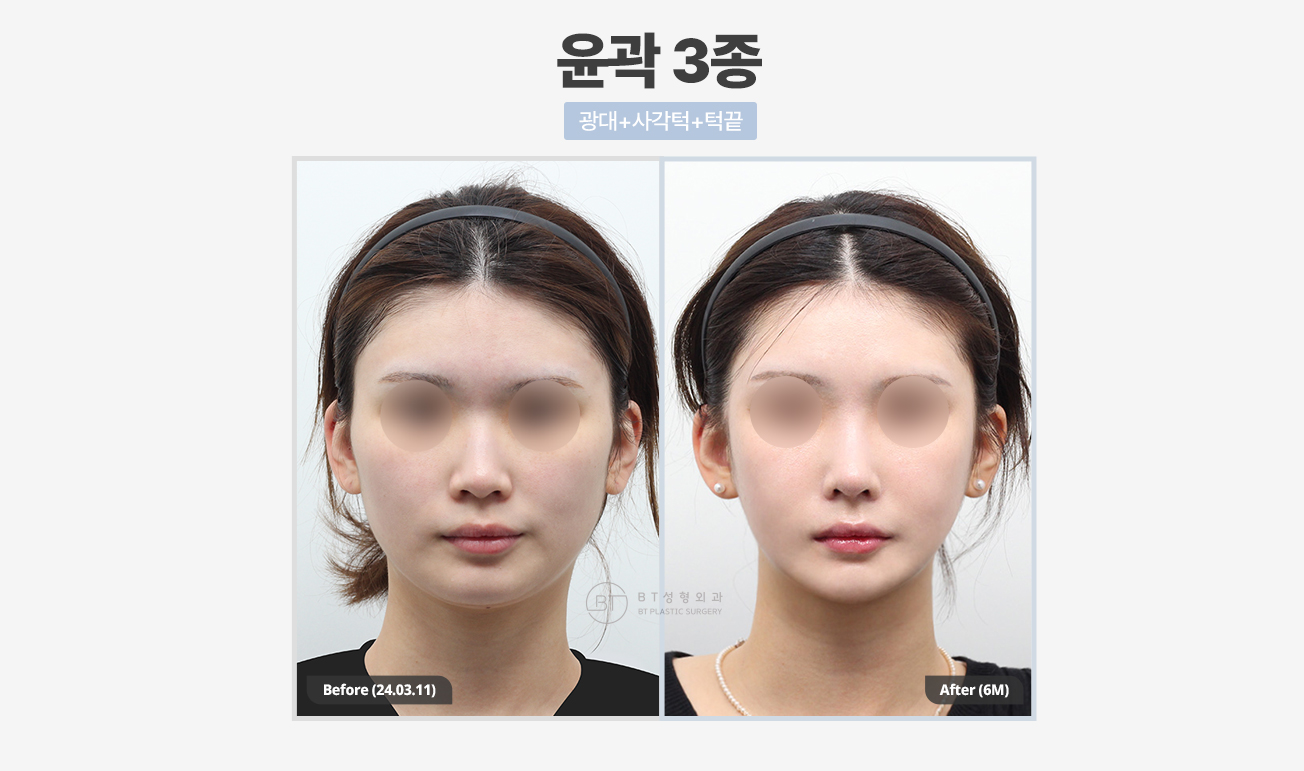 비티성형외과 대표 이미지