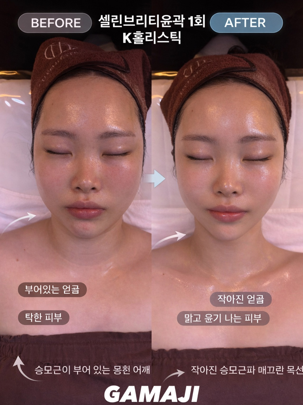 가마지에스테틱 대표 이미지