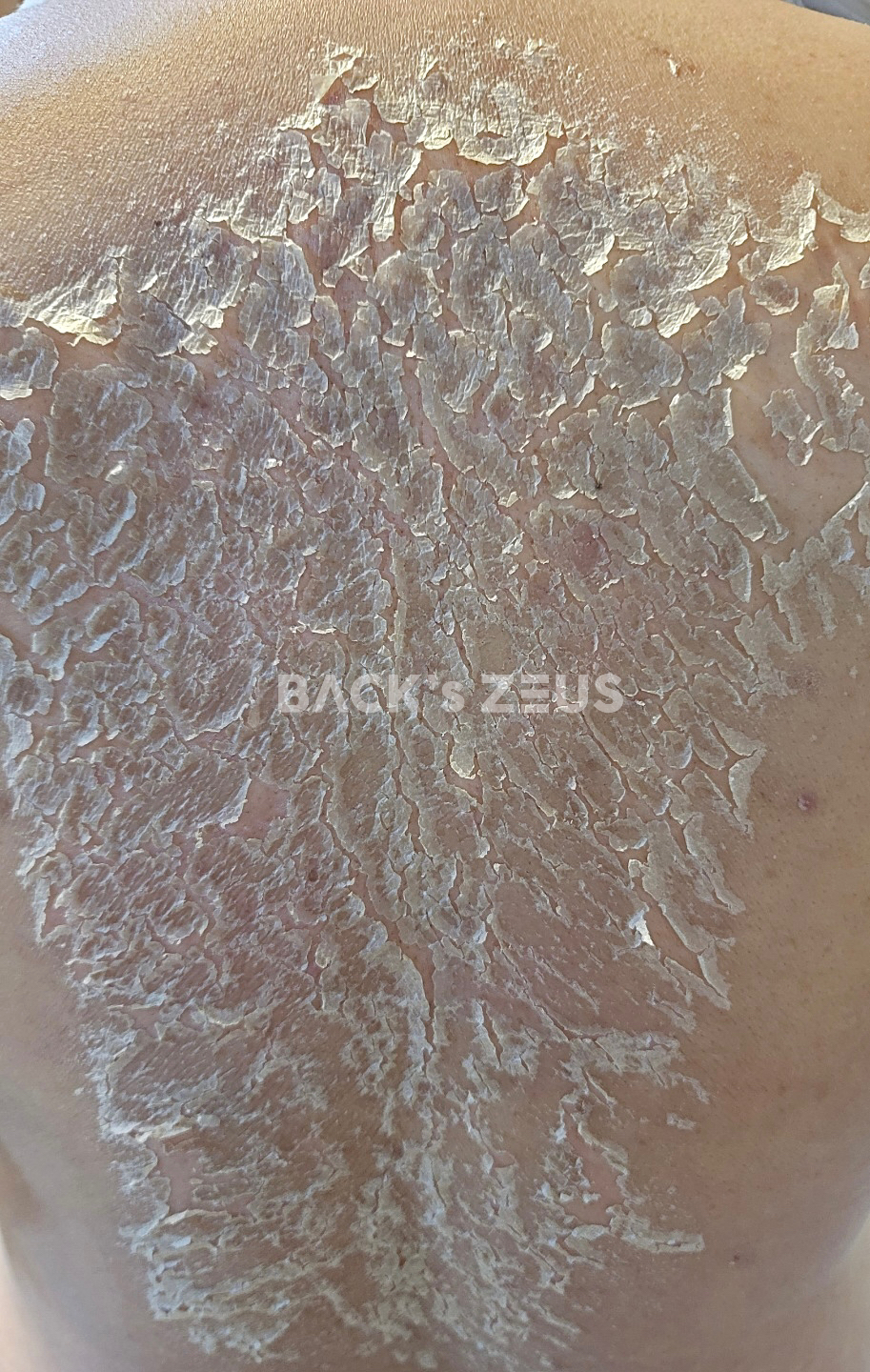 제로스킨 홍대 대표 이미지