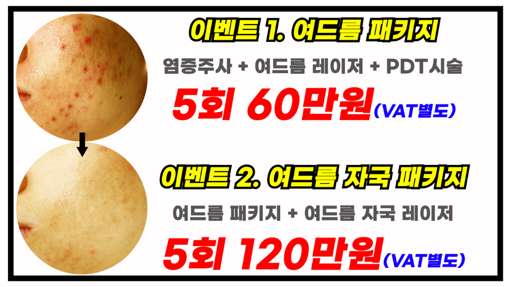 아크네마인드의원 대표 이미지