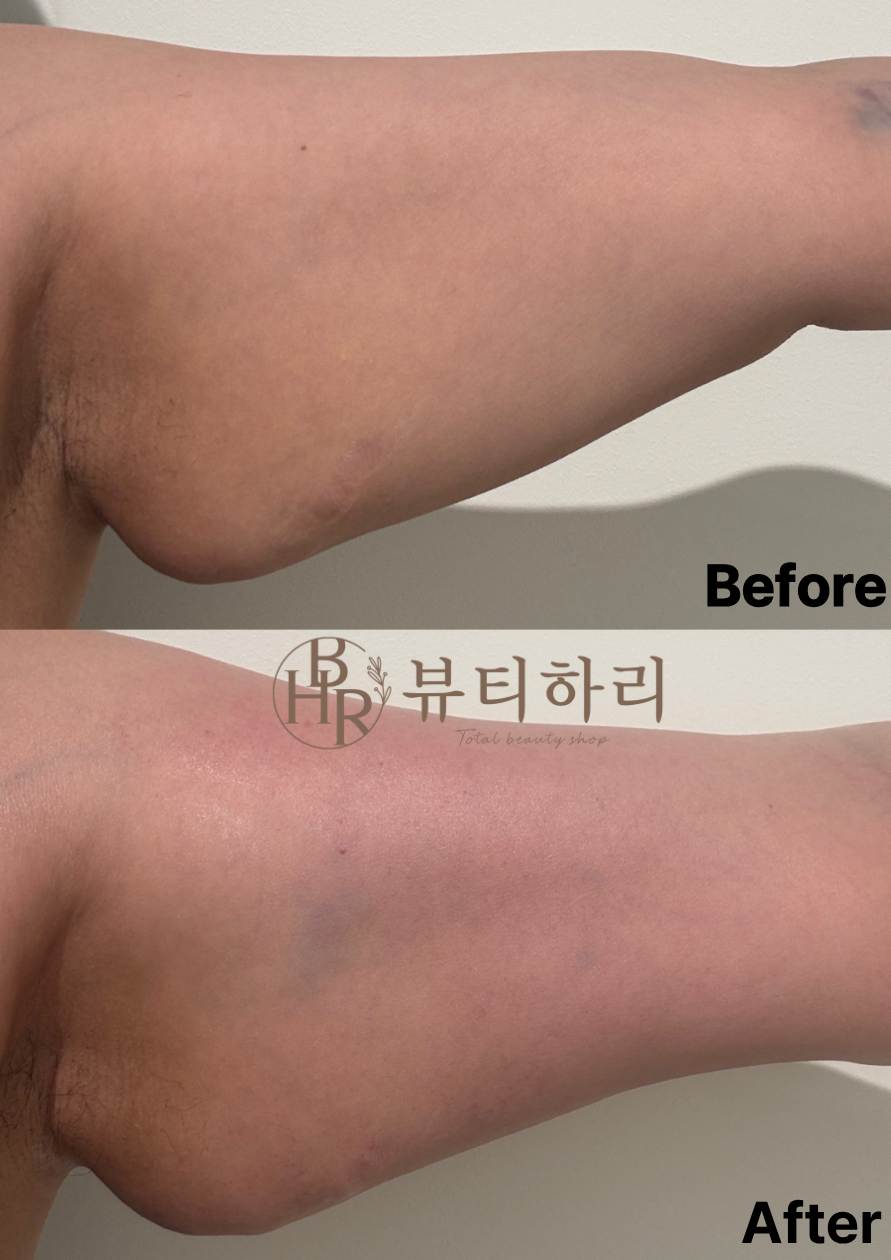 뷰티하리 대표 이미지