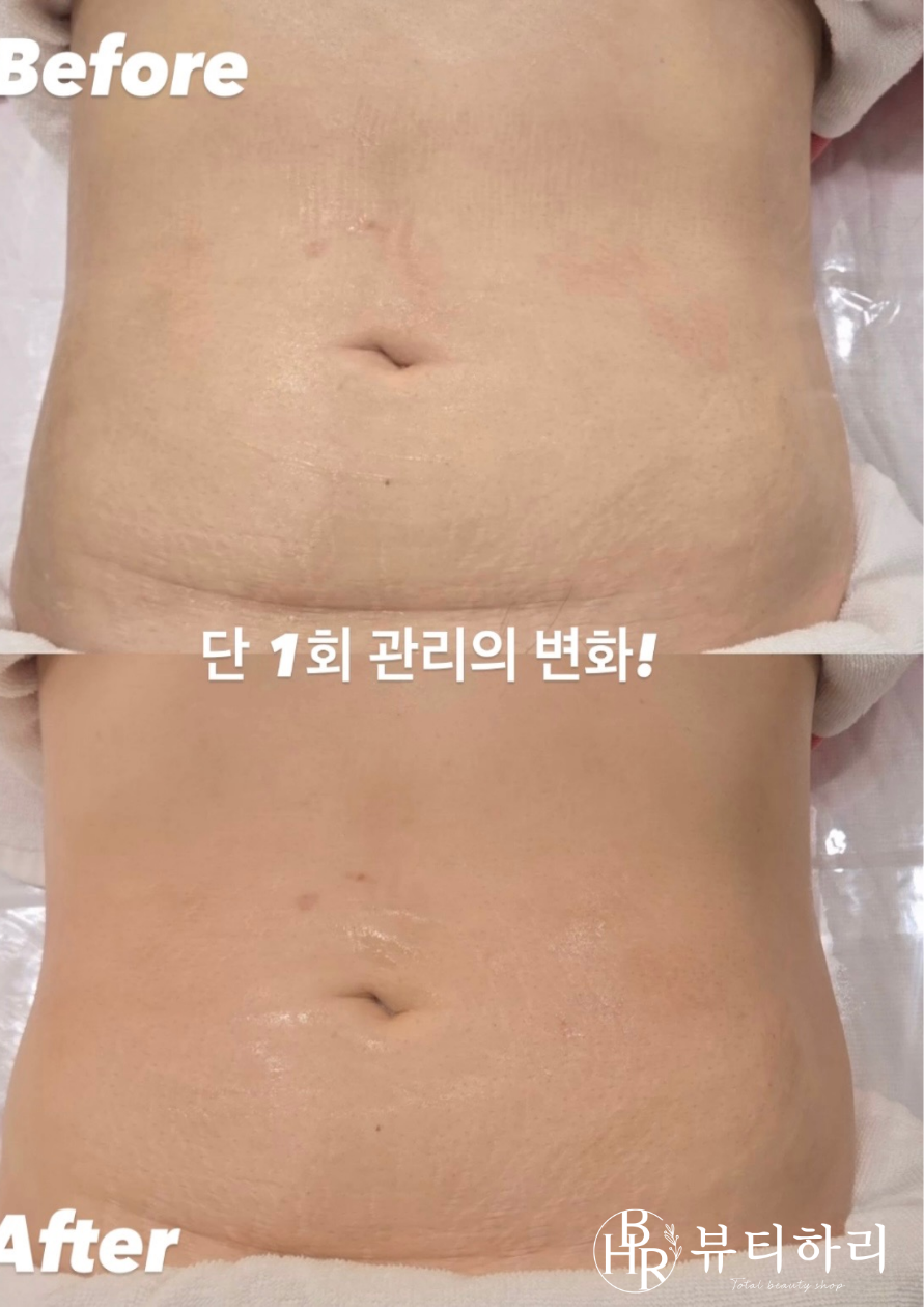뷰티하리 대표 이미지