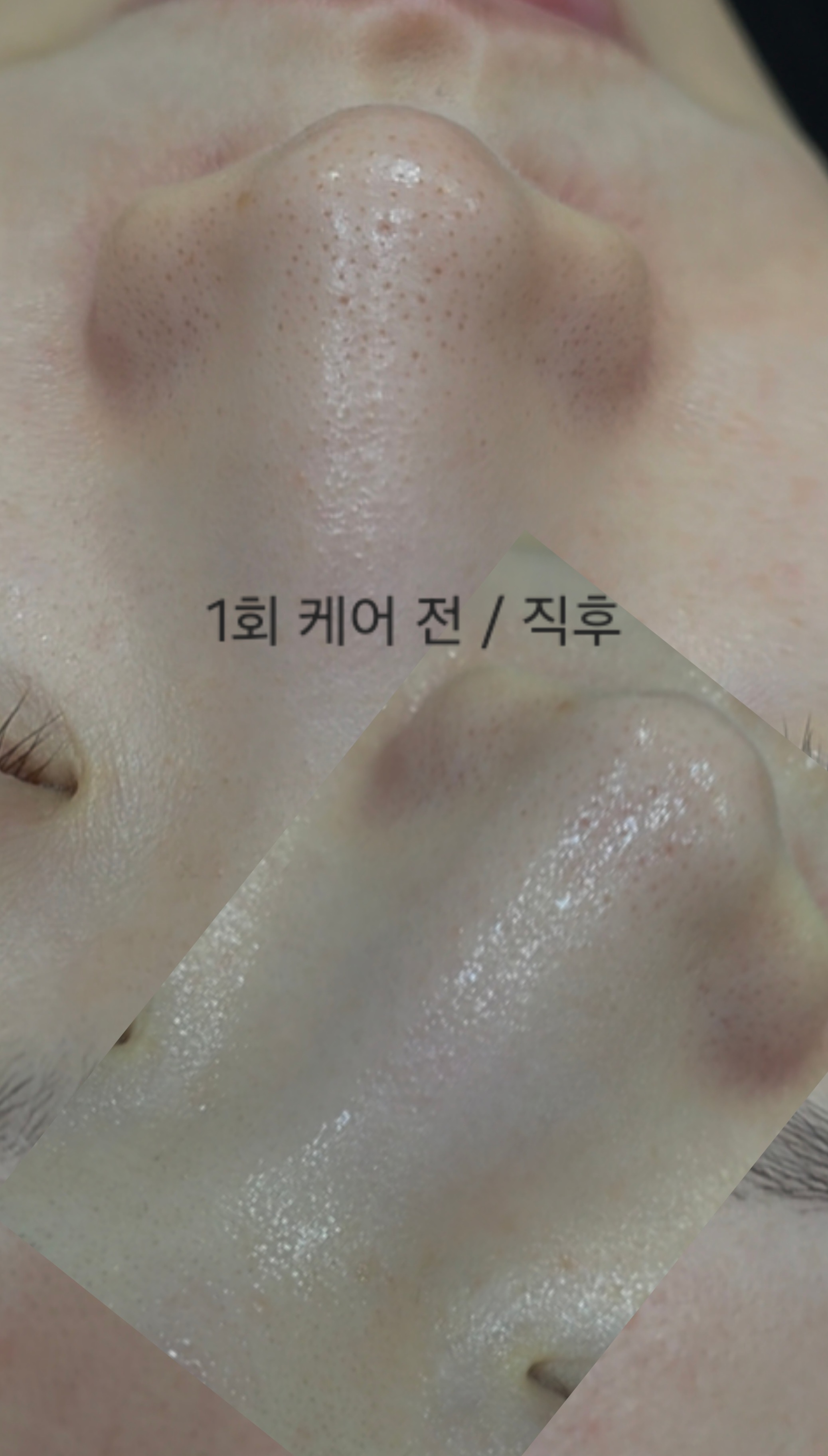 가인스킨샵 은평본점