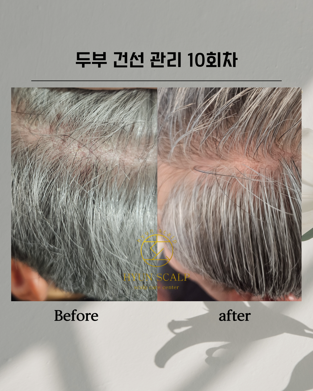 현스칼프 이대점 대표 이미지